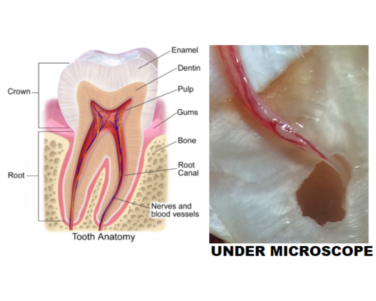 Microscopic Root Canal in Ahmedabad: Cost, Procedure, Pain & When It’s Worth It.